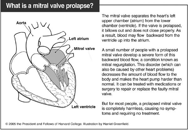 heart-valve-voice-mitral-regurgitation