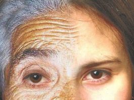 Erasing the Creases of Time