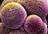 Ethical questions about stem cells