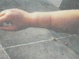 Council bites into thorny dog ordinance debate