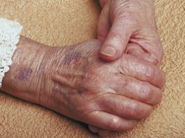 Project Homeless Connect returns to Gilroy