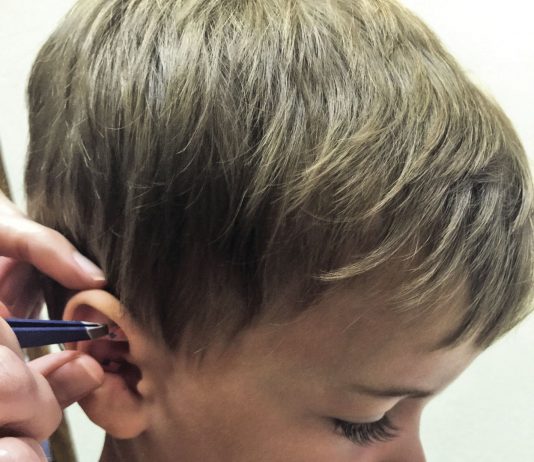 Healing children with acupuncture