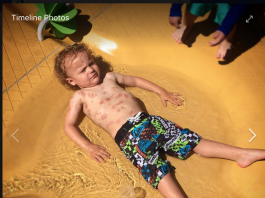 Boy with rare condition mistreated at Gilroy Gardens Water Oasis, family says